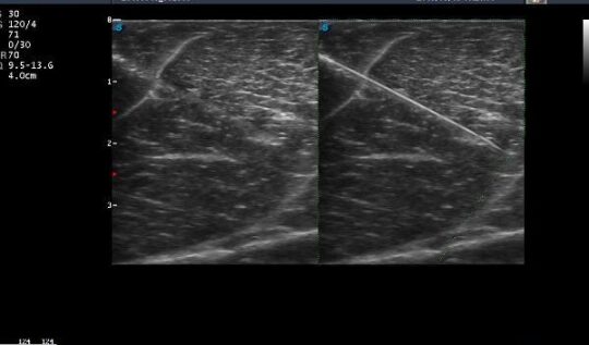 Imaging interventistico: le nuove frontiere