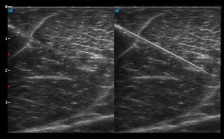 Imaging interventistico: le nuove frontiere